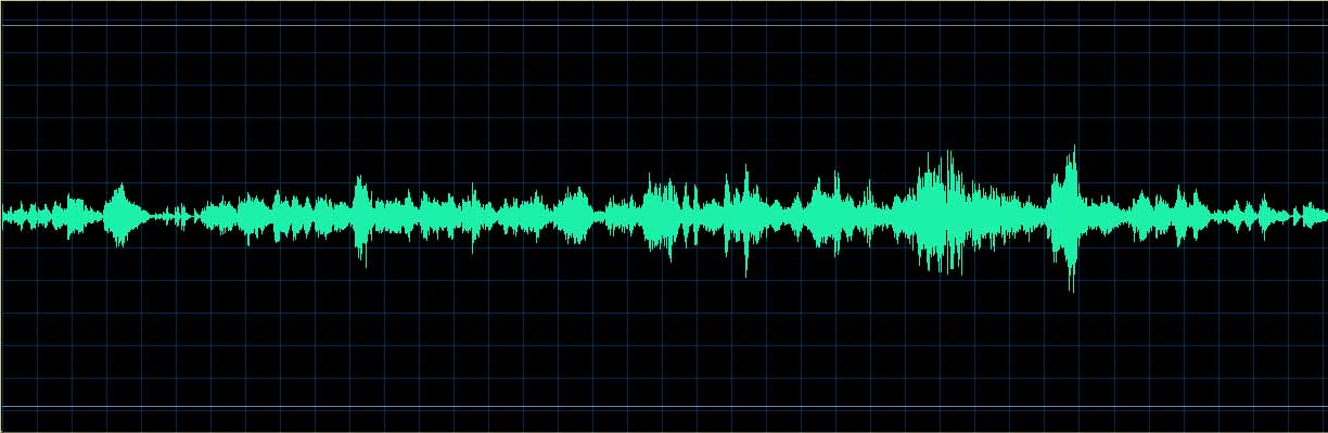 Ronald Brautigam waveform