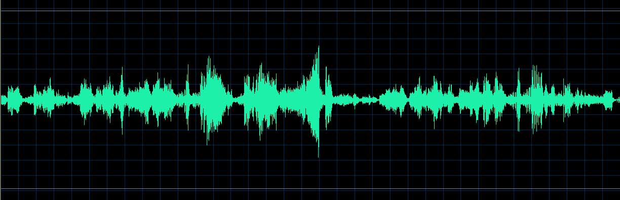 Jean-Philippe Collard waveform